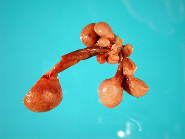 Really. pictures of vulva with polyps opinion you That interrupt pictures of vulva with polyps